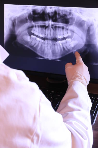 Best Emergency Treatment for Dental Infections or Abscesses in Friendly, MD