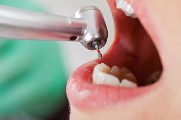 Best Weekend Emergency Dentist in Friendly, MD